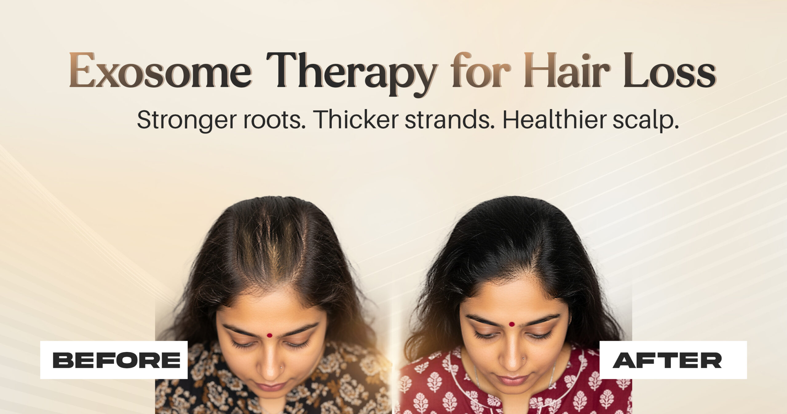 The Most Advanced Hair Regrowth Treatment