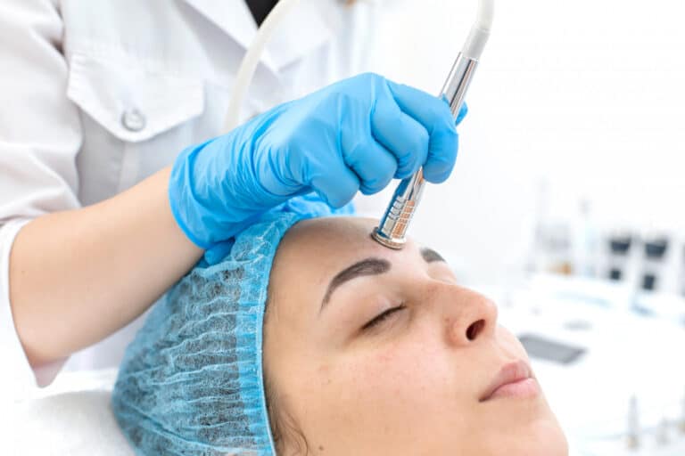 Microdermabrasion